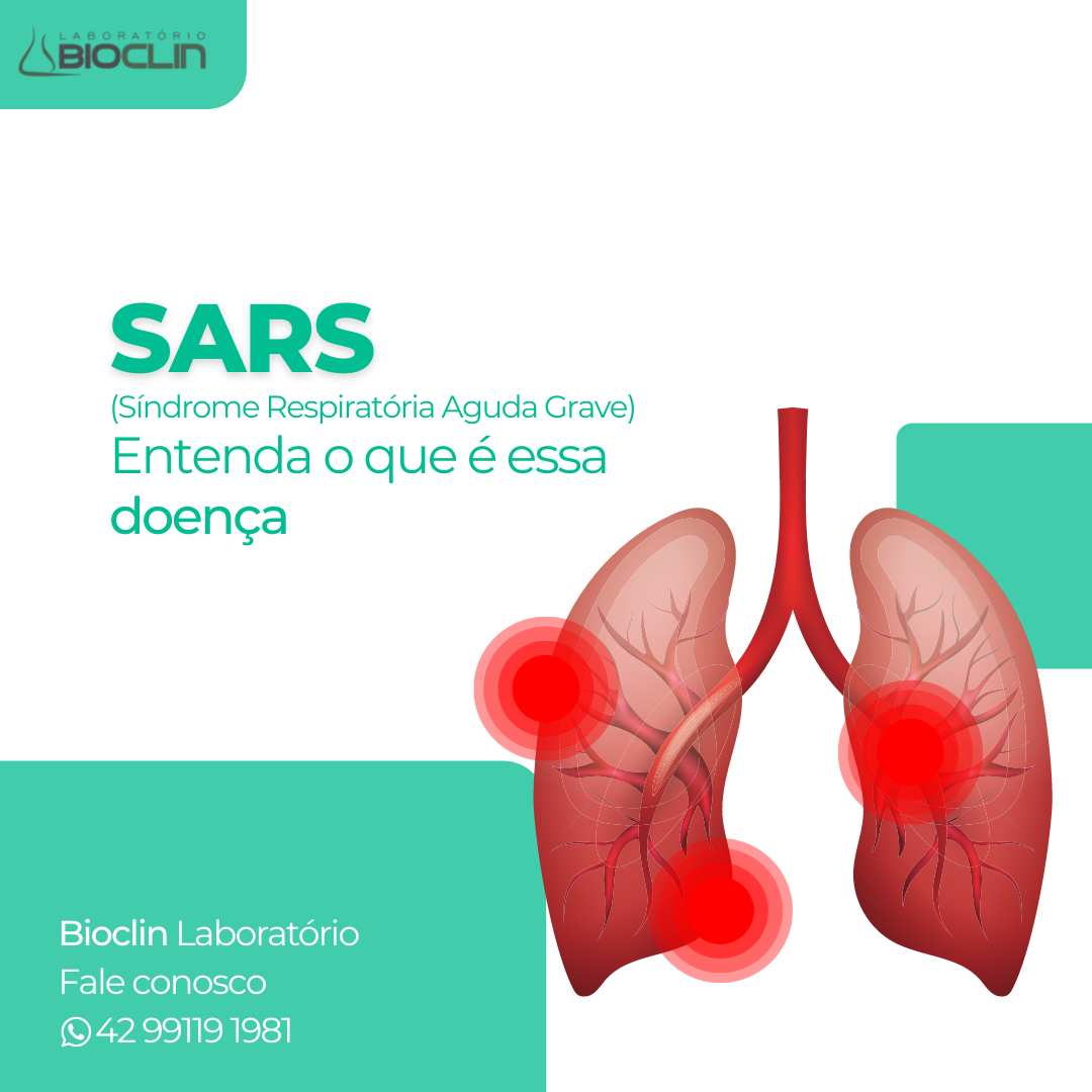 Síndrome Respiratória Aguda Grave SRAG Laboratório Bioclin